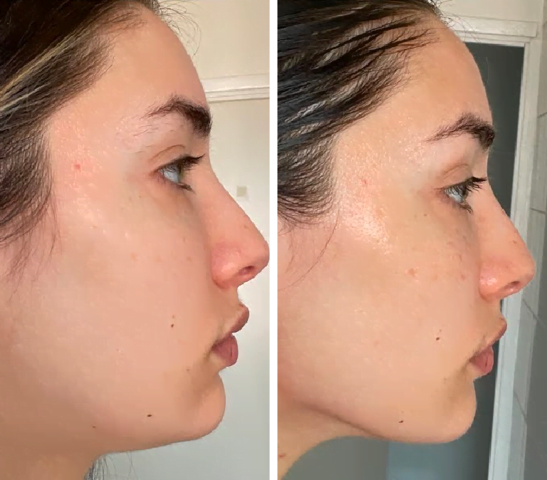stainless gua sha